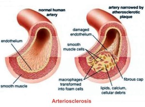 arterio